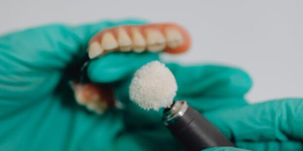 Zalety i wady protezy na implantach all-on-4