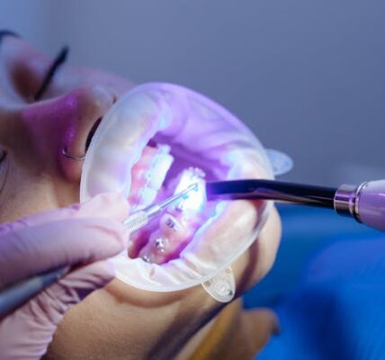 aparat ortodontyczny przeciwwskazania