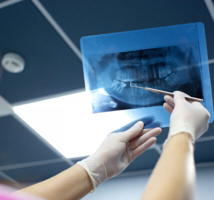 Czy RTG zębów wykryje stan zapalny?