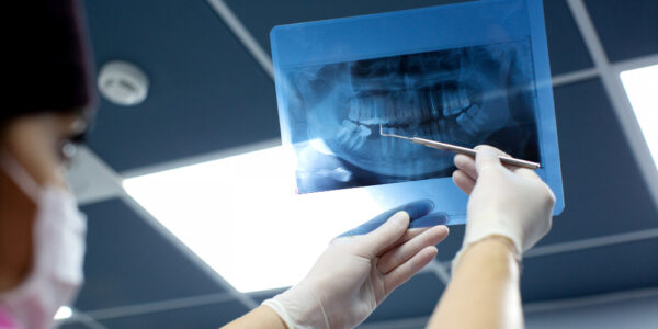Czy RTG zębów wykryje stan zapalny?