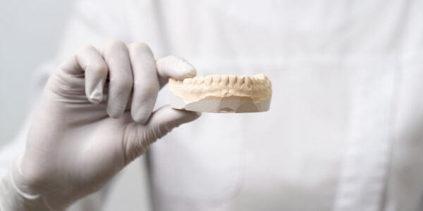 Jak wygląda adaptacja do protezy na implantach?