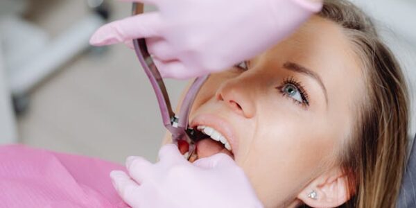 Jak długo boli ząb po wstrząsie i czy to normalne?