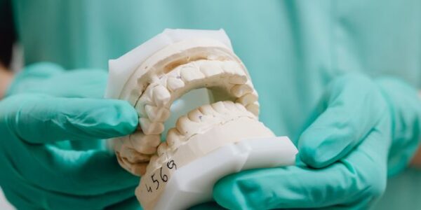 Nieprzyjemny zapach spod protezy na implantach – co może być przyczyną?