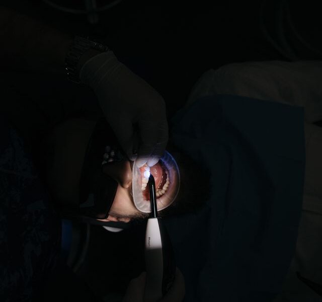 Czy można wszczepić implant wiele lat po utracie zęba?
