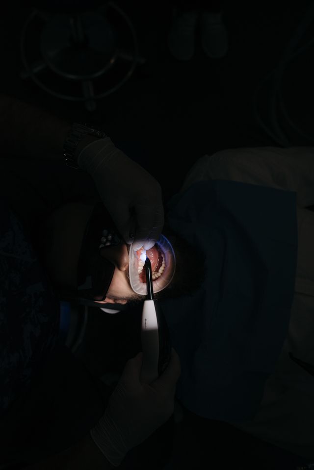 Czy można wszczepić implant wiele lat po utracie zęba?